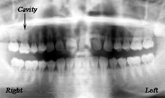 Dentistry medical treatment