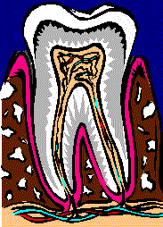 歯周疾患の進行